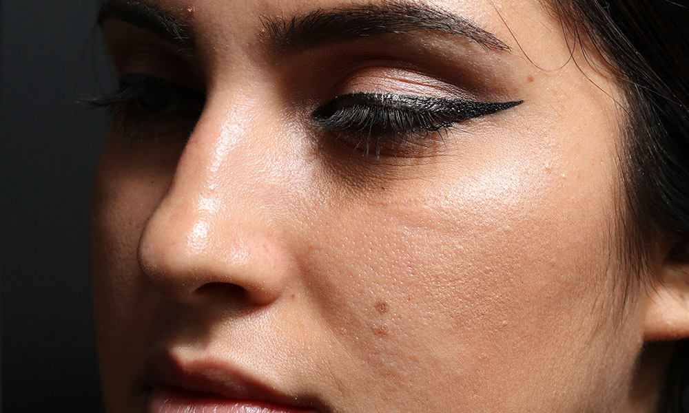 Non Surgical Rhinoplasty Before and After | Dr. Ashlin Alexander