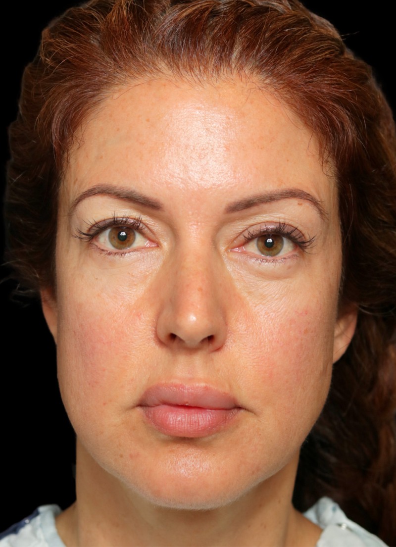 Before transformation