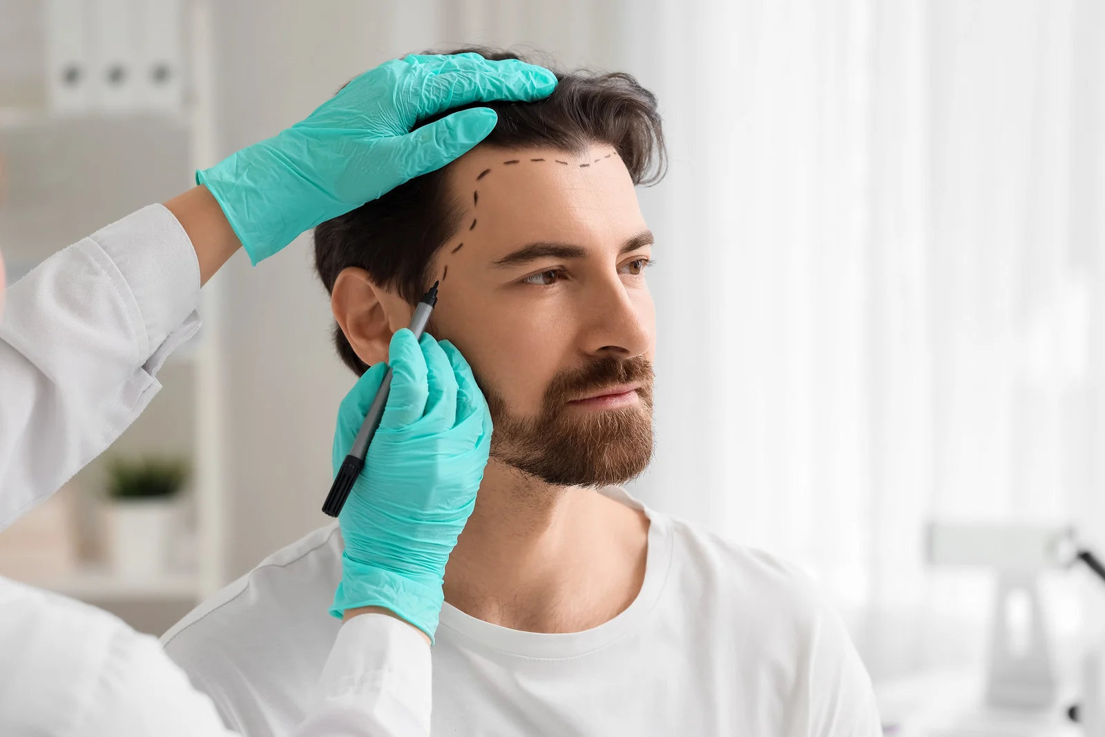 Hair Transplant